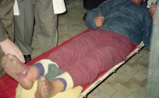 haydar celayir'in ayakları morarmıştı